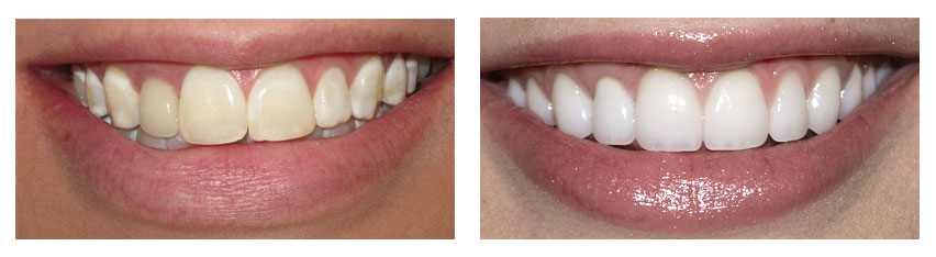 Cosmetic Dentistry