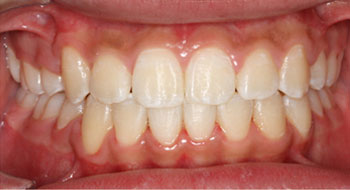 ortho-after-7