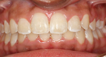 ortho-after-8