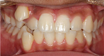 ortho-before-7