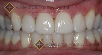 whitecrossdental